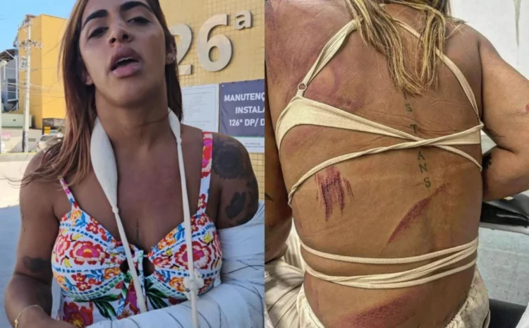 Transfobia: Transsexual espancada em Cabo Frio